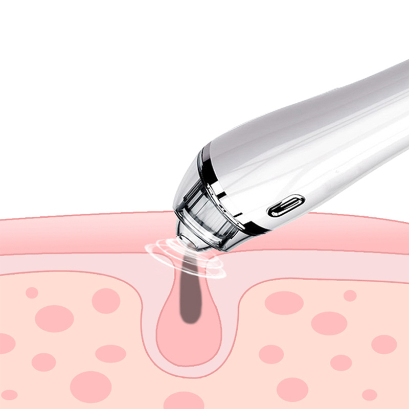 Odkurzacz do usuwania zaskórników Odkurzacz porów Elektryczny zaskórnik ssący Facedo Comedo Acne Extractor Tool dla kobiet i mężczyzn