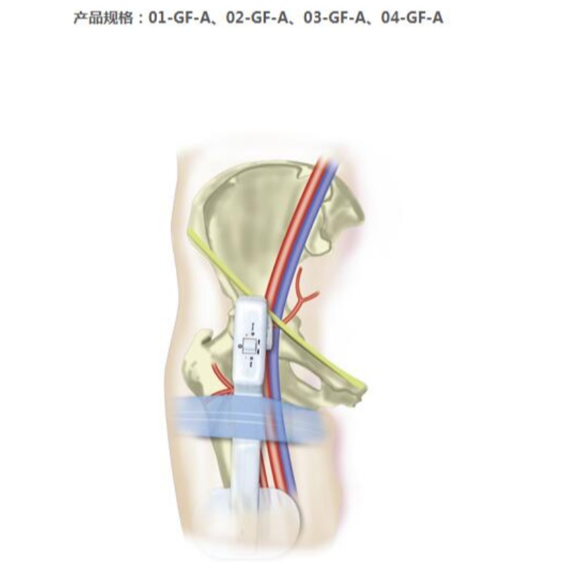 Urządzenie kompresyjne Goldfinger Electronic Femoral Hemostasis
