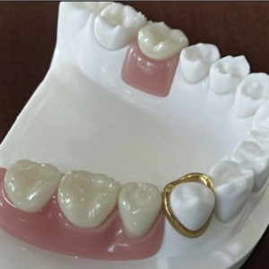 Precyzyjne przywiązanie