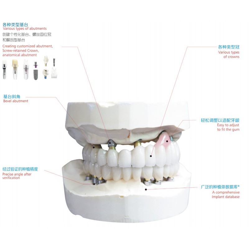 Implant dentystyczny
